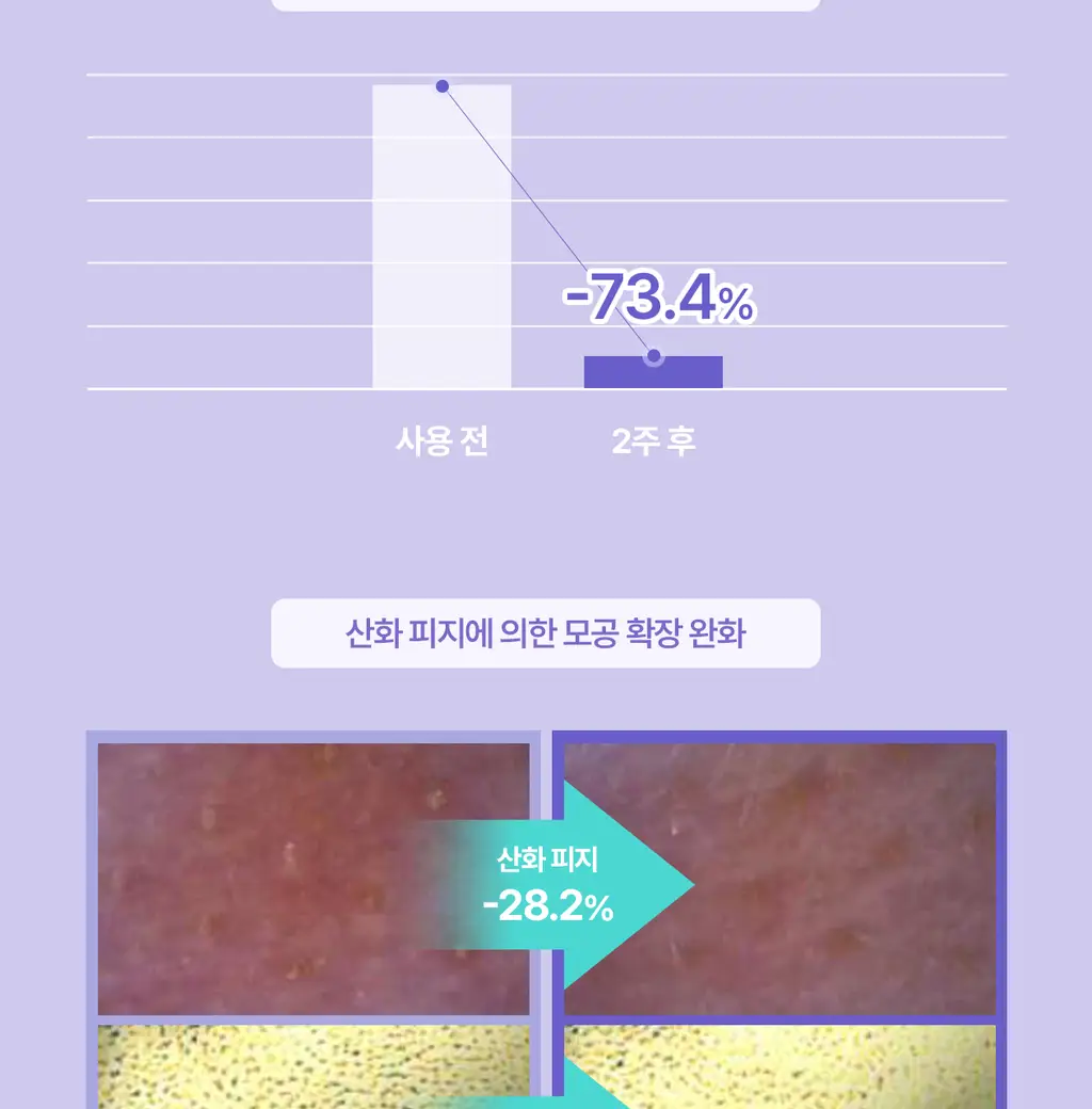[5월 올영픽/126매 대용량/올리브영 단독] 리쥬란 포어 타이트닝 토너 패드 60매 더블 한정 기획 상세페이지 23